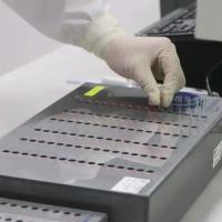 细菌内毒素联检